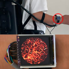 Wearable Photoacoustic Imaging Watch Blood Vessels