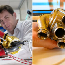 Texas BiVACOR Total Artificial Heart Patient