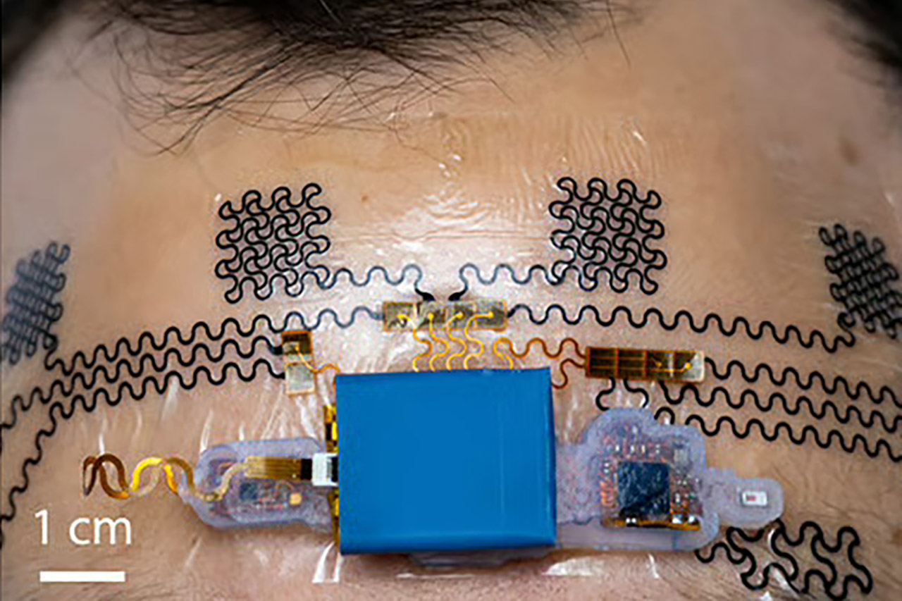 Forehead E-Tattoo Brain Stress Levels