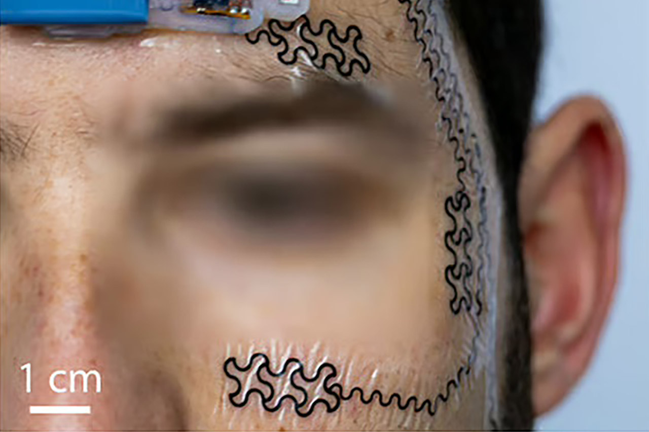 Forehead E-Tattoo Brain Stress Levels
