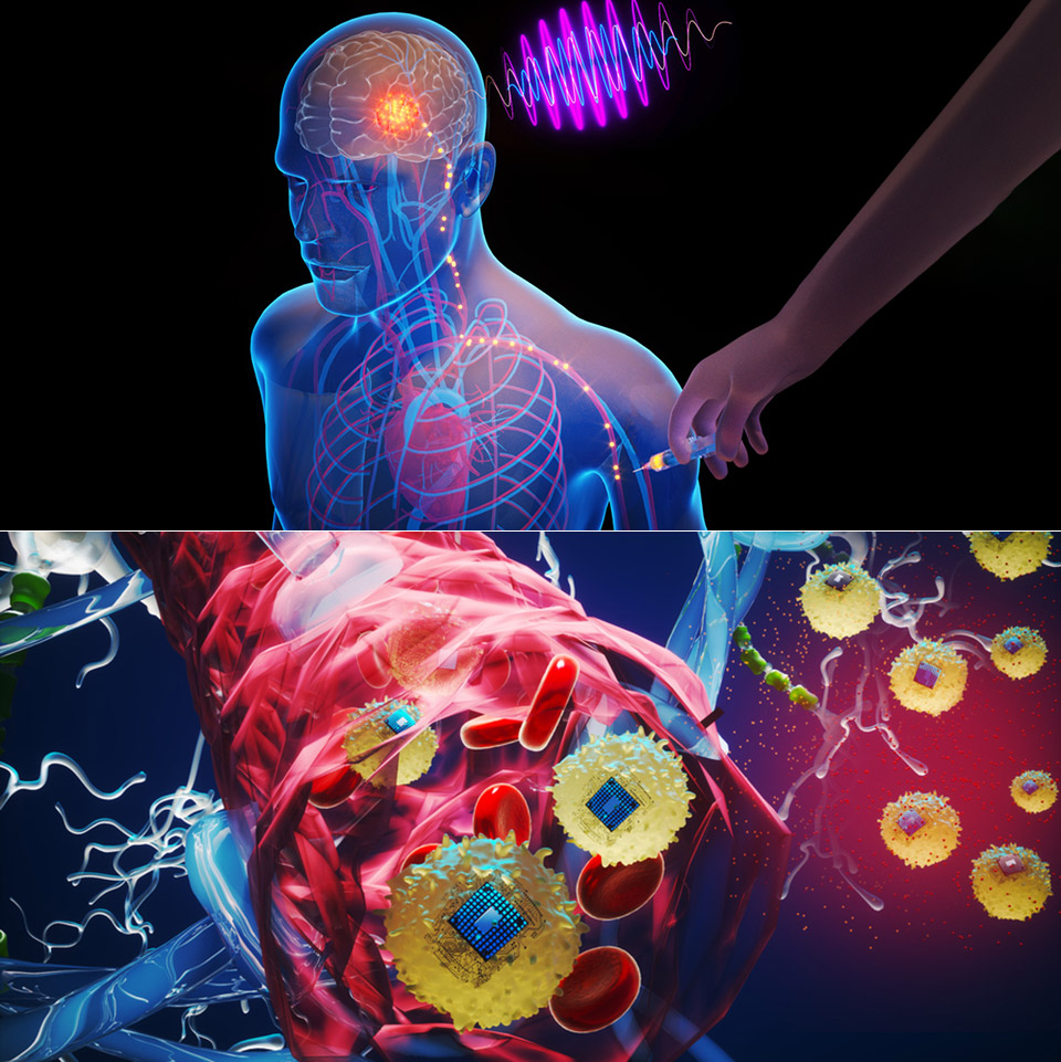 MIT Injectable Brain Chips Treatment