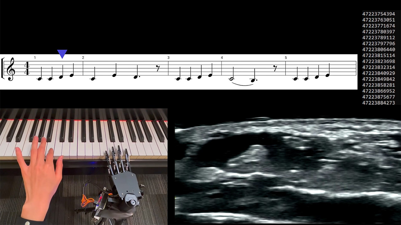 MIT Real-Time Hand Tracker Wristband