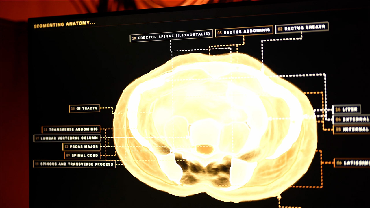 Midjourney Medical Body Scanner MRI Ultrasound Spa