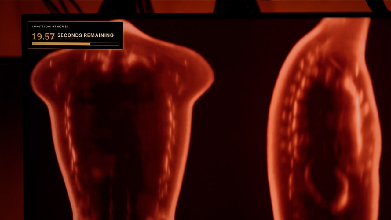 Midjourney Medical Body Scanner MRI Ultrasound Spa
