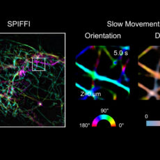 SPIFFI Microscope Living Cells Real-Time