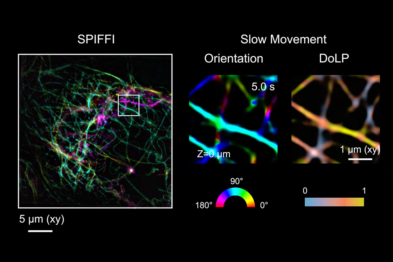 SPIFFI Microscope Living Cells Real-Time