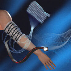 MIT Shape-Sensing Sheet Skin Physical Therapy