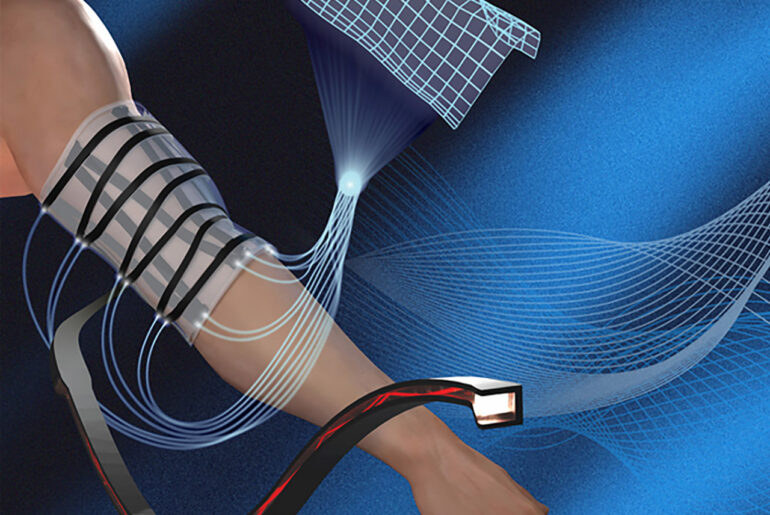 MIT Shape-Sensing Sheet Skin Physical Therapy